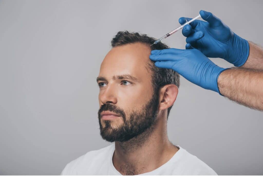 Traitement de la chute des cheveux, Homme | Cabinet Médecine Esthétique Vannes